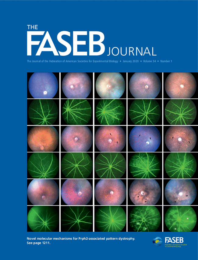 FASEB Journal Volume 34 Issue 1